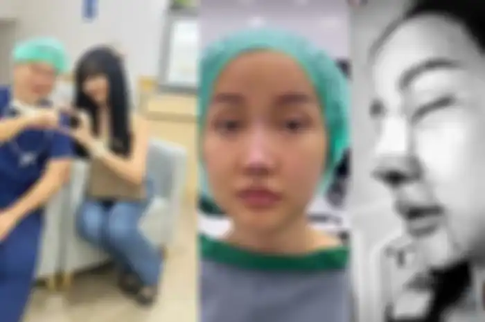 Lucinta Luna operasi lagi, kini ubah bagian hidung