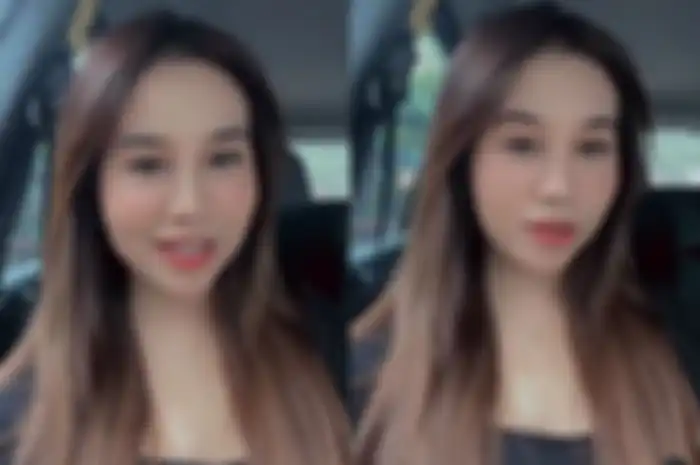 Mayang, adik Vanessa Angel ingin kembali lakukan operasi plastik