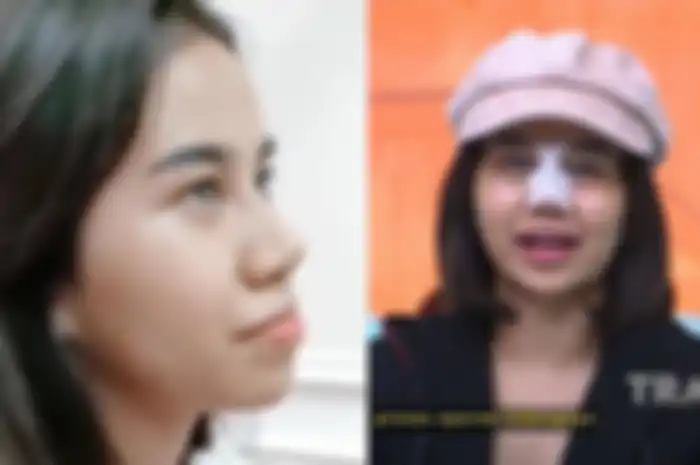 Tak kapok operasi plastik demi tampil glow up, Mayang berencana bakal lakukan oplas lagi