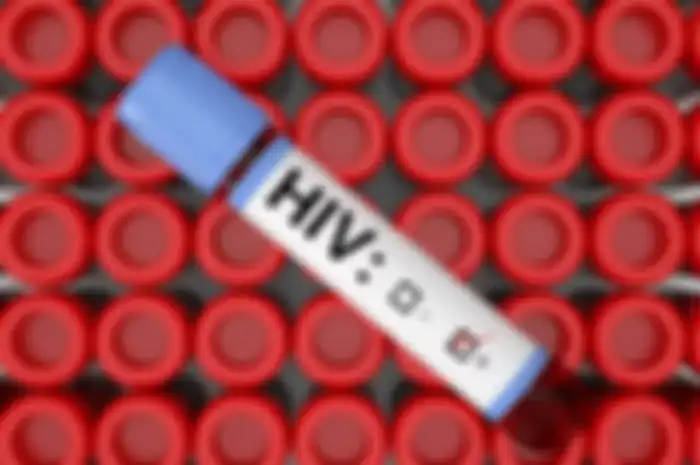 4 Faktor Risiko HIV yang Harus Diwaspadai