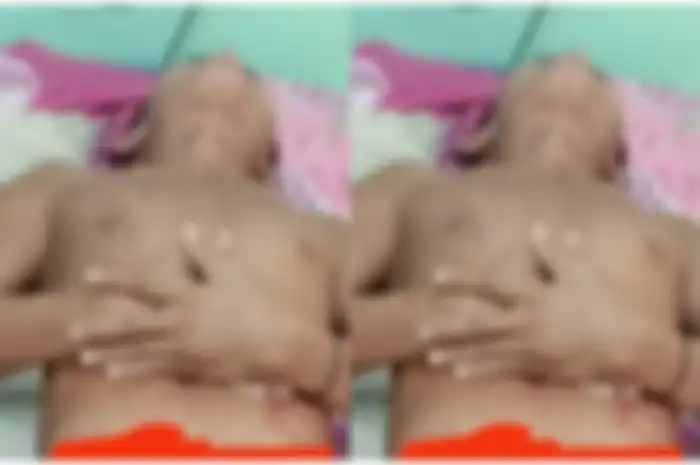 foto OG, lelaki yang kemaluannya dipotong pacar selingkuhan berinisial AST 