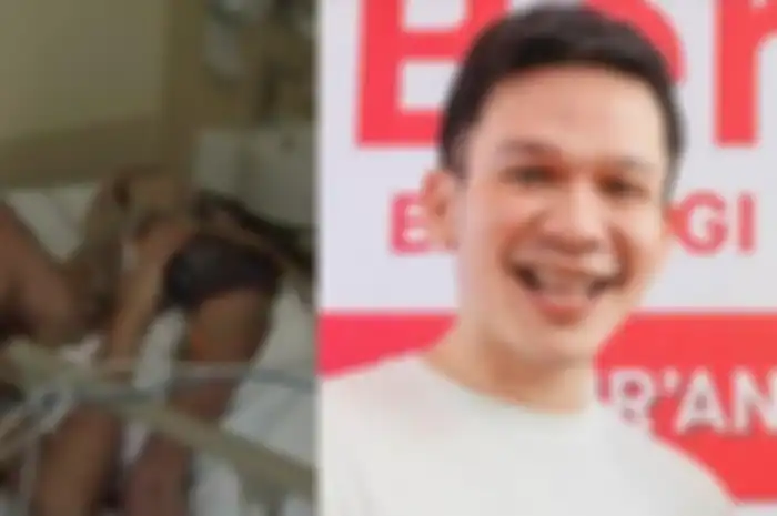 Tak mau ruben Onsu capek, Jordi Onsu mendadak khawatirkan kondisi kesehatan sang kakak