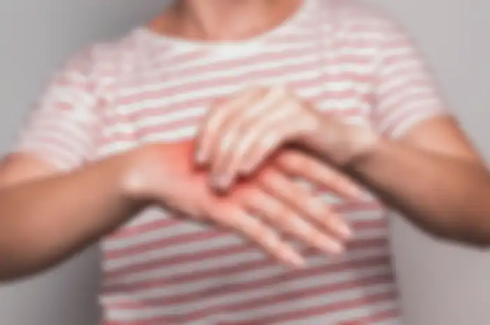ilustrasi Carpal tunnel syndrome (CTS) atau saraf kejepit di tangan 