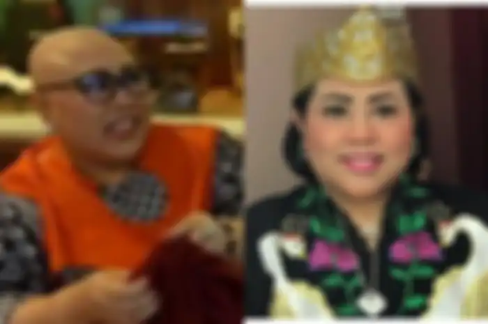 Nunung jalani kemoterapi setelah divonis derita kanker payudara
