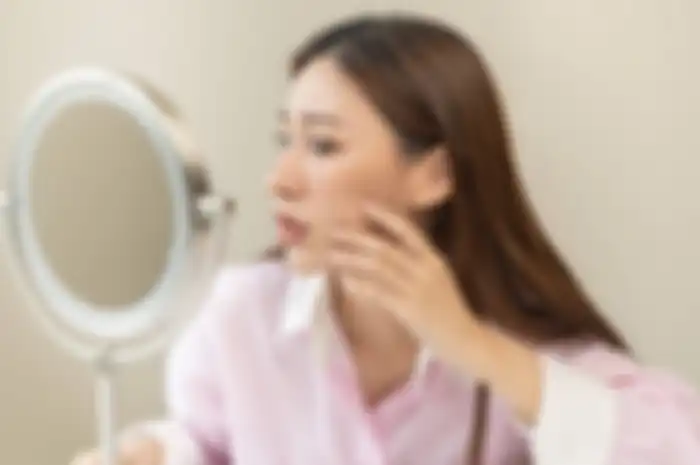 Cara mengatasi iritasi kulit wajah