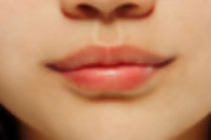 Cara mengatasi bibir pecah-pecah dengan mudah.