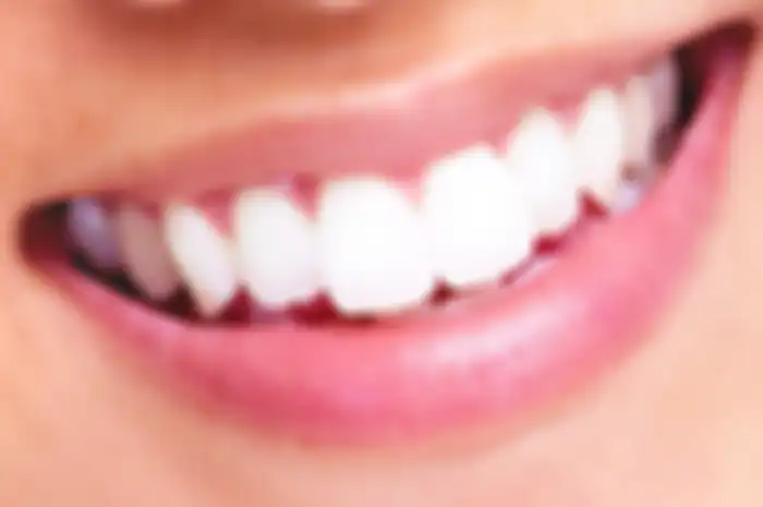 Rekomendasi whitening strip