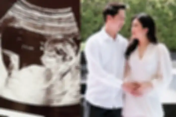 Bakal Jadi Cucu Konglomerat, Jenis Kelamin Calon Anak Pertama Kevin Sanjaya dan Valencia Tanoesoedibjo Akhirnya Terkuak!