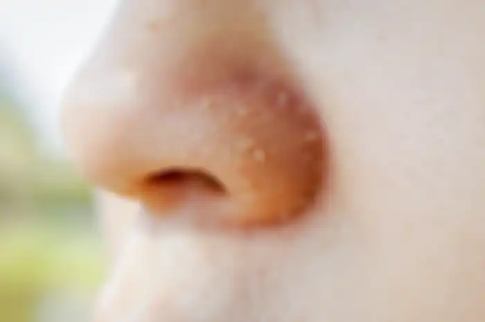 Cara hilangkan kulit kering di hidung