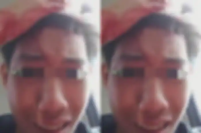 Ayah Tega Bacok Kepala Anaknya hingga Bersimbah Darah