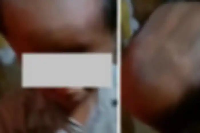 Viral oknum guru di Samosir cukur muridnya asal-asalan hingga botak setengah.