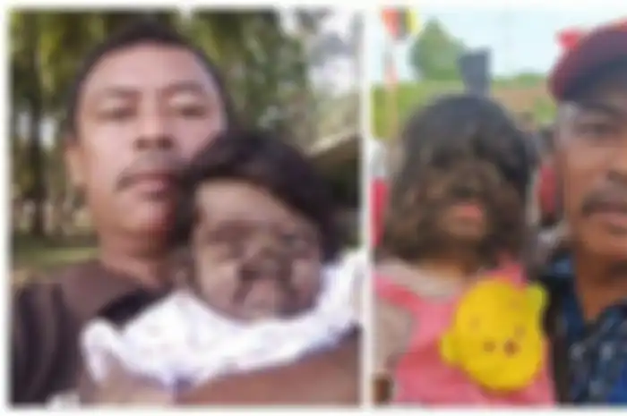 Bayi perempuan bernama Missclyen yang lahir dengan Werewolf Syndrome. Missclyen diundang untu bertemu dengan Raja Malaysia Sultan Yang di-Pertuan Agong Al-Sultan Abdullah Ri'ayatuddin Al-Mustafa Billah dan Raja Permaisuri Agong Tunku Azizah Aminah Maimunah Iskandariah. Gadis itu dijuluki "anak dari surga".