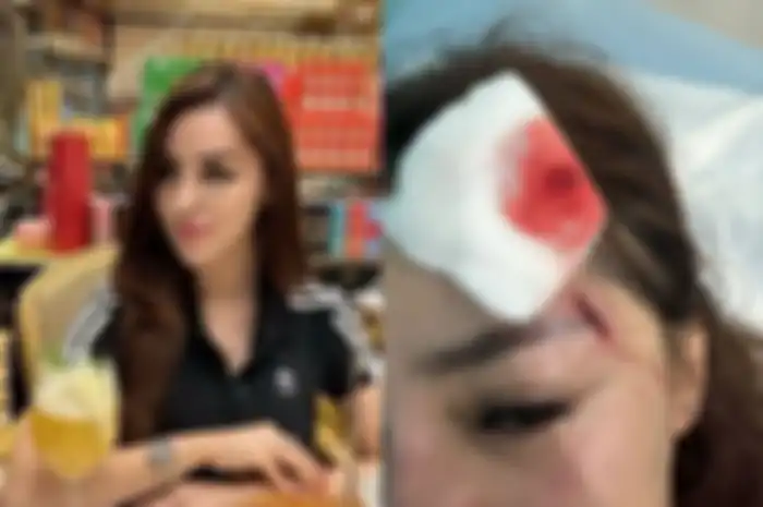 Selebgram Safa Marwah dianiaya pacarnya sendiri