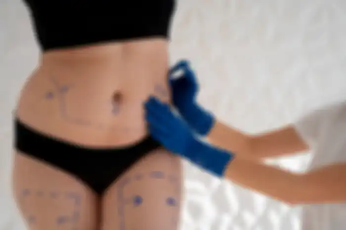 Coolsculpting 