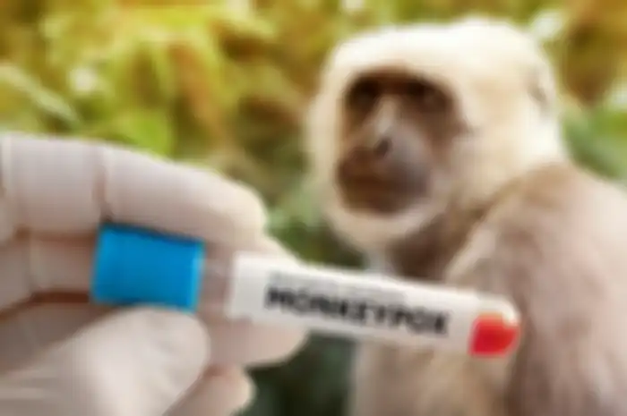 Cacar monyet atau monkeypox 