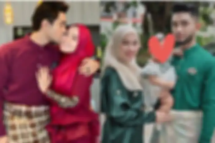 Pasangan artis ini ikhlas putri mereka terlahir sumbing dan cacat jari