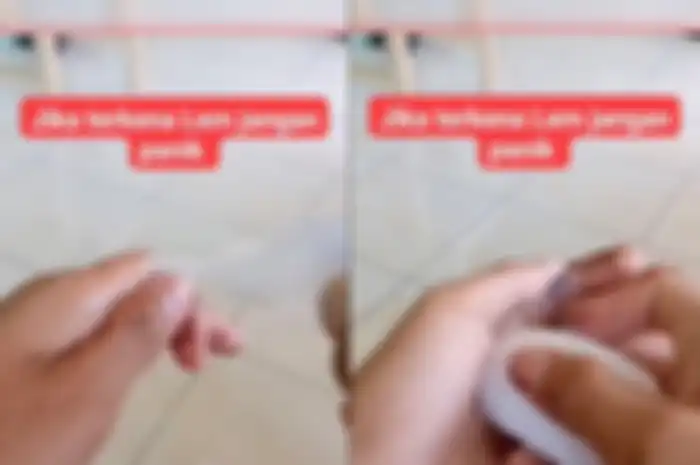 Tutorial atasi tangan yang terkena lem Korea ini viral di TikTok.