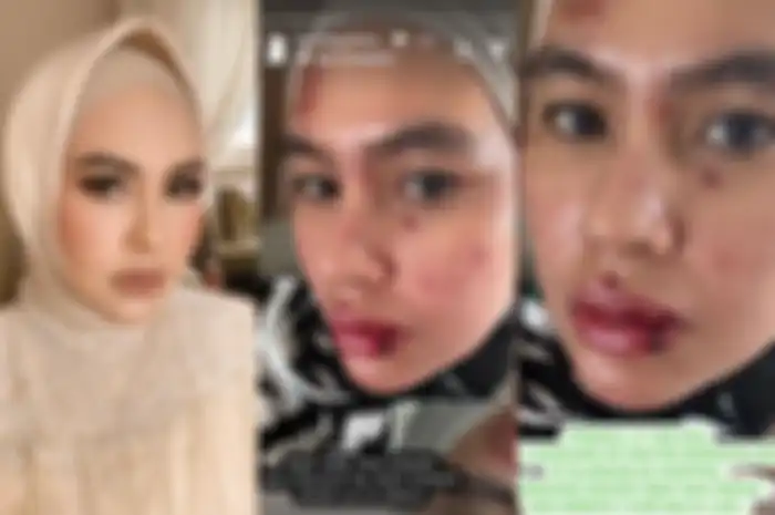 Kartika Putri alami penyakit misterius.