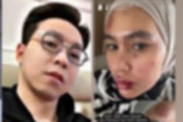 Dokter Richard Lee dan Kartika Putri