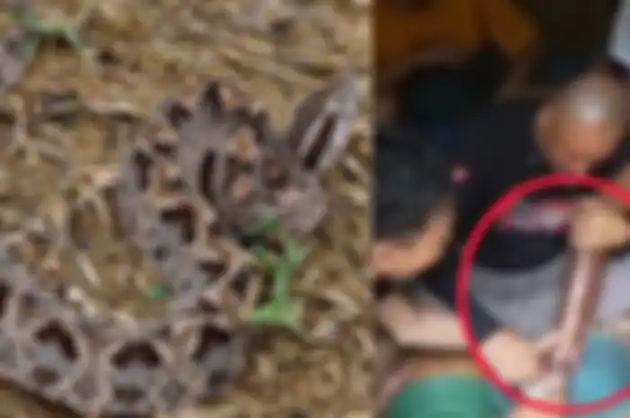 Foto yang menampilkan salah satu kaki seorang bocah tampak gosong karena digigit ular tanah 