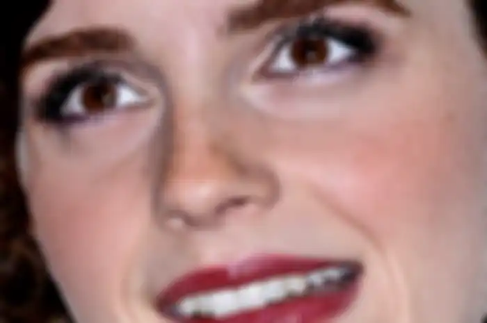 What's Wrong With Your Teeth, Emma?