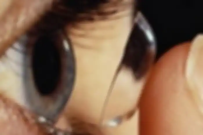 Bahaya Salah Memakai Softlense