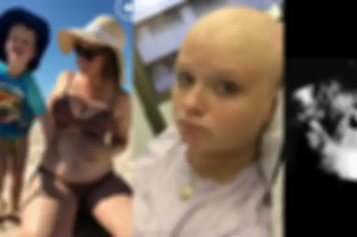 Lauren Knowles, melahirkan tumor