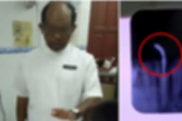Kisah wanita yang salah periksa di klinik dokter gigi.