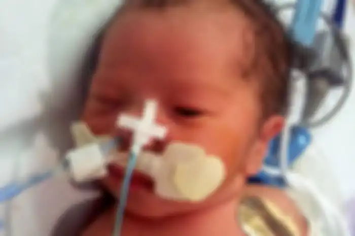 Bayi meninggal dunia setelah operasi.