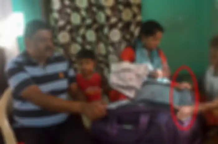 Anak dengan sisik ular bersama keluarga | Newslions SWNS