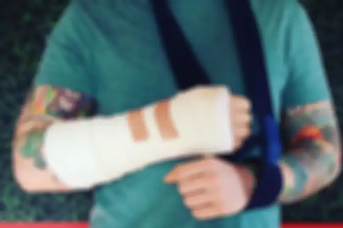 Ed Sheeran Kecelakaan