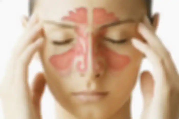 Ilustrasi Sinusitis