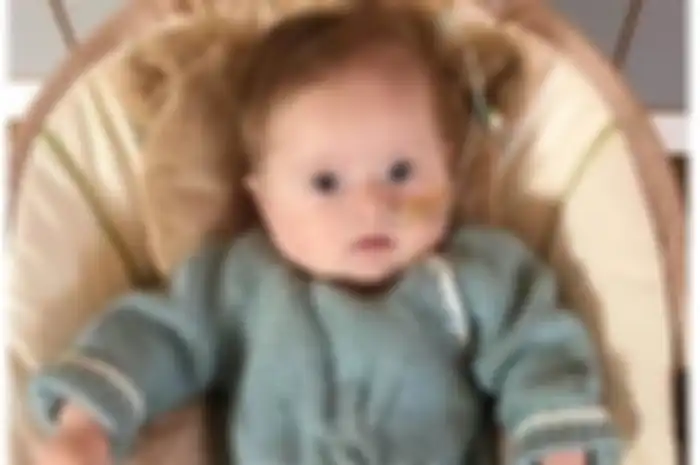 Baby Iris meninggal karena salah diagnosa