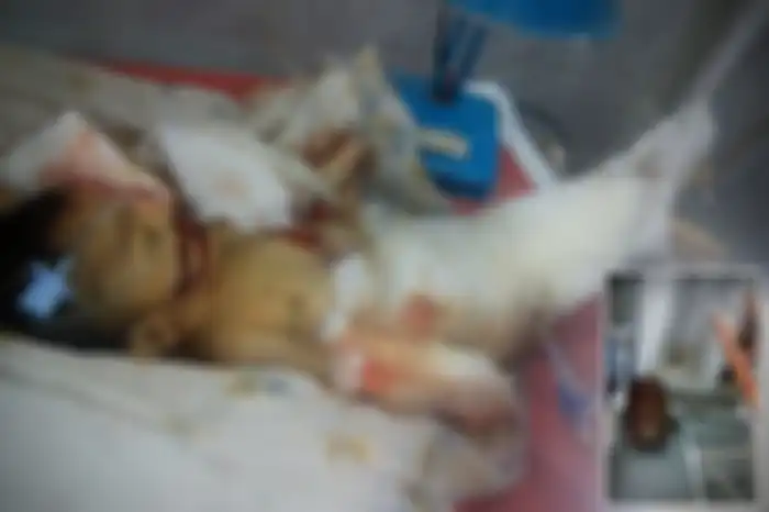Bayi Berumur 10 Hari Tewas Dibunuh Tikus 