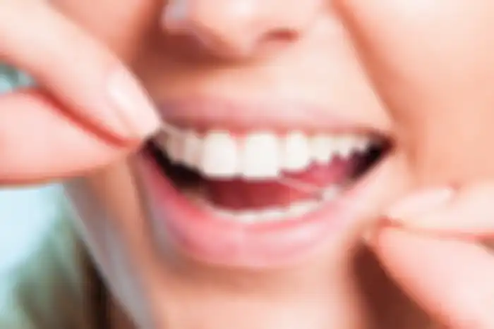 Flossing gigi