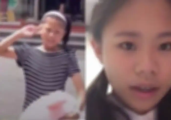 Wajah Xiao Z Na Na sebelum operasi plastik