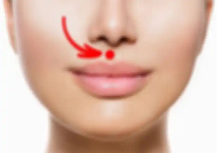 Pijatan untuk hidung tersumbat.