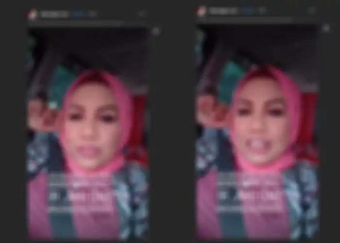 Unggahan Elly Sugigi yang sebut biaya potong gigi