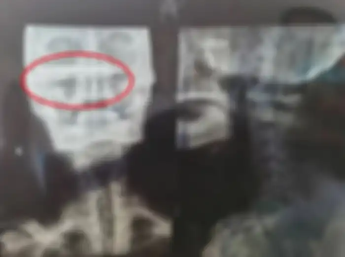 Hasil CT Scan menunjukkan bilah pisau menancap di dalam kepalanya