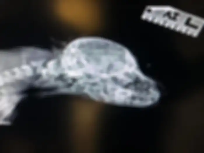 Hasil X-Ray Narhwal yang menunjukkan bahwa ekor kecil di dahinya nggak terhubung dengan organ atau syaraf tubuh.