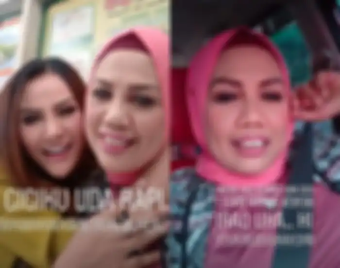 Potret penmapilan baru Elly Sugigi dengan bentuk gigi yang lebih rapi hingga bikin netizen pangling