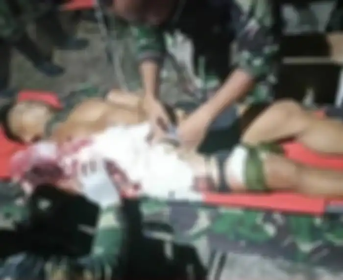 Foto Komandan Pos Marinir TNI AL yang gugur di Papua tersebar di media sosial. Anggota Marinir itu mengalami luka berat di bagian lengan. 