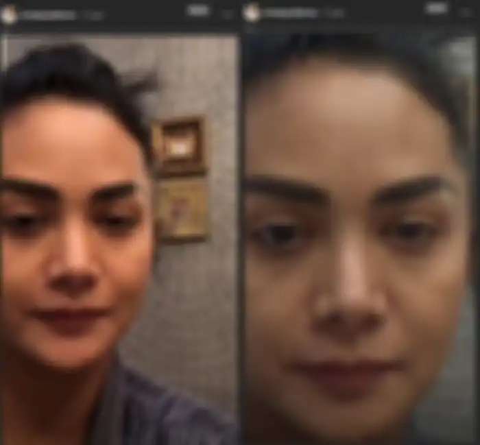 Akui Lakukan Operasi Plastik, Begini Wajah Asli Krisdayanti Tanpa Makeup