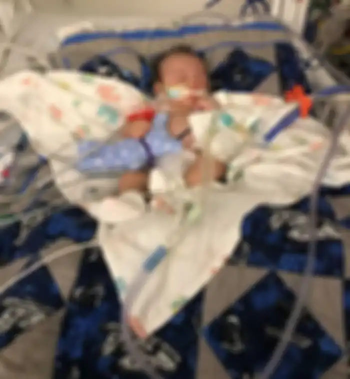 Bayi Xavier saat mengalami koma. 
