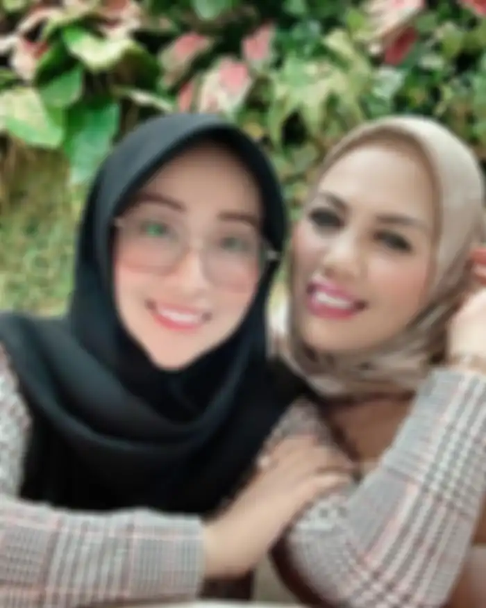Elly Sugigi setelah merapikan gigi