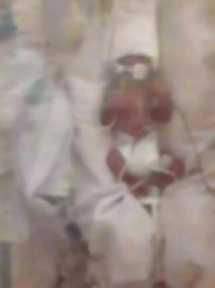 Ibu Hamil Kecanduan Narkoba, Begini Kondisi Mengenaskan sang Bayi Kala Lahir yang Menyayat Hati