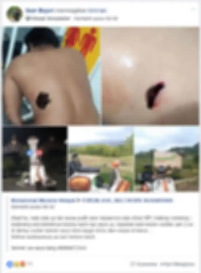 Korban begal di Danau Sunter.