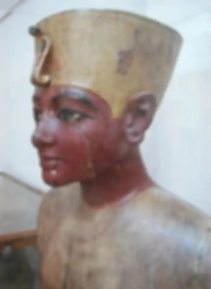 2. Raja Tutankhamun, menderita cacat tengkorak