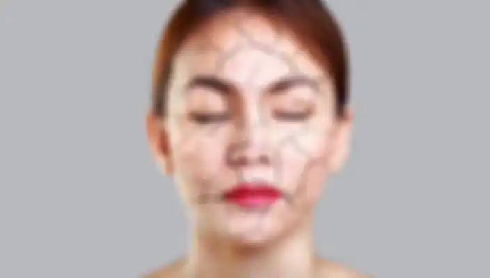 kulit kering