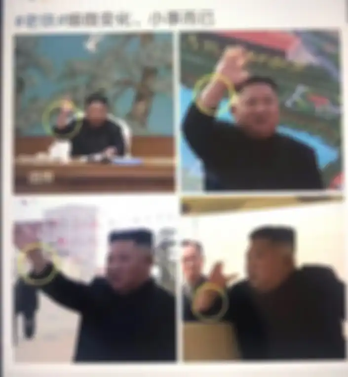 Aktivis hak asasi manusia, Jennifer Zeng menyandingkan potret Kim Jong Un sebelum rumor meninggal dan Kim Jong Un setelah rumor meninggal